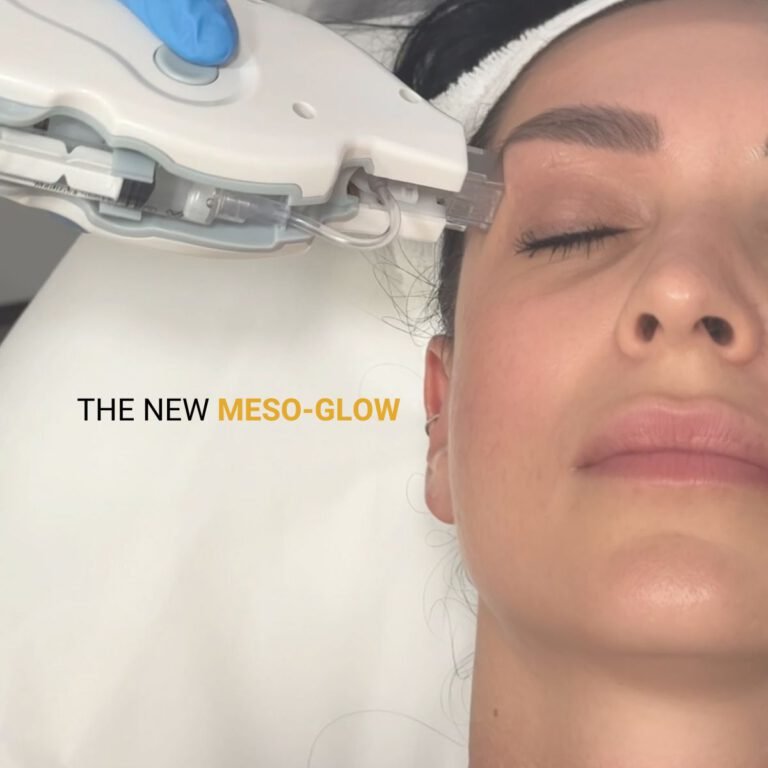 THE NEW MESO-GLOW