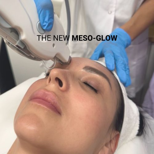 the new meso-glow (2)